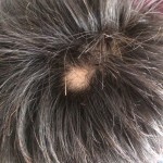 衝撃!ハゲていることが発覚!ハゲになって初めてわかった5つのこと